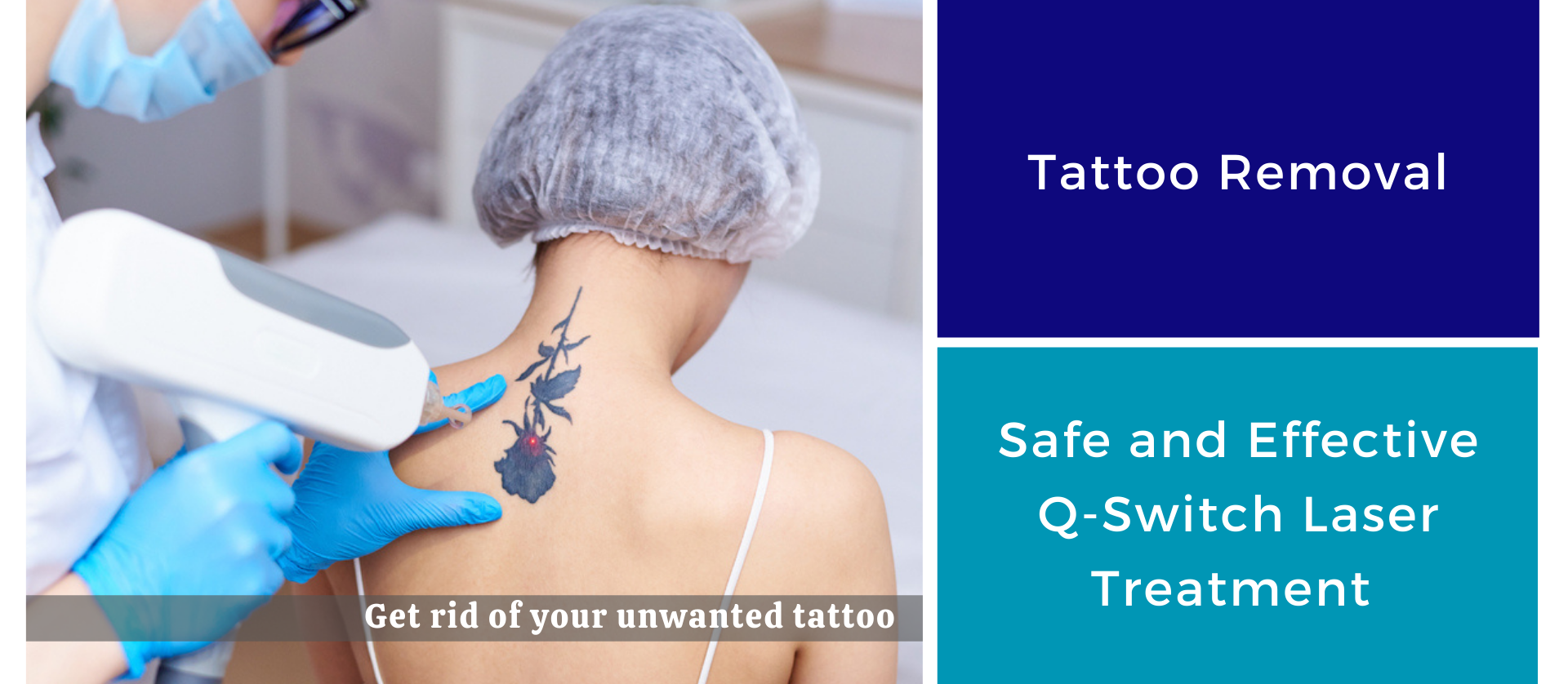 Tattoo Removal Laser Technology - The Bombay Skin Clinic