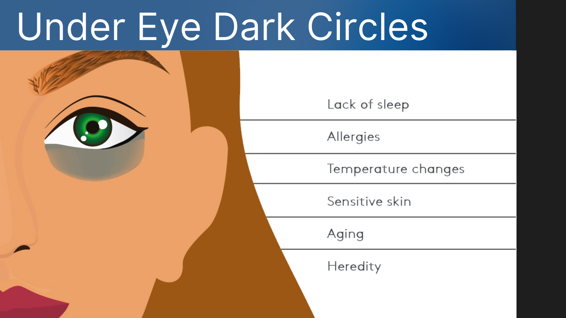 Dark circles under eyes